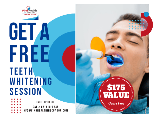 Free Teeth Whitening Session